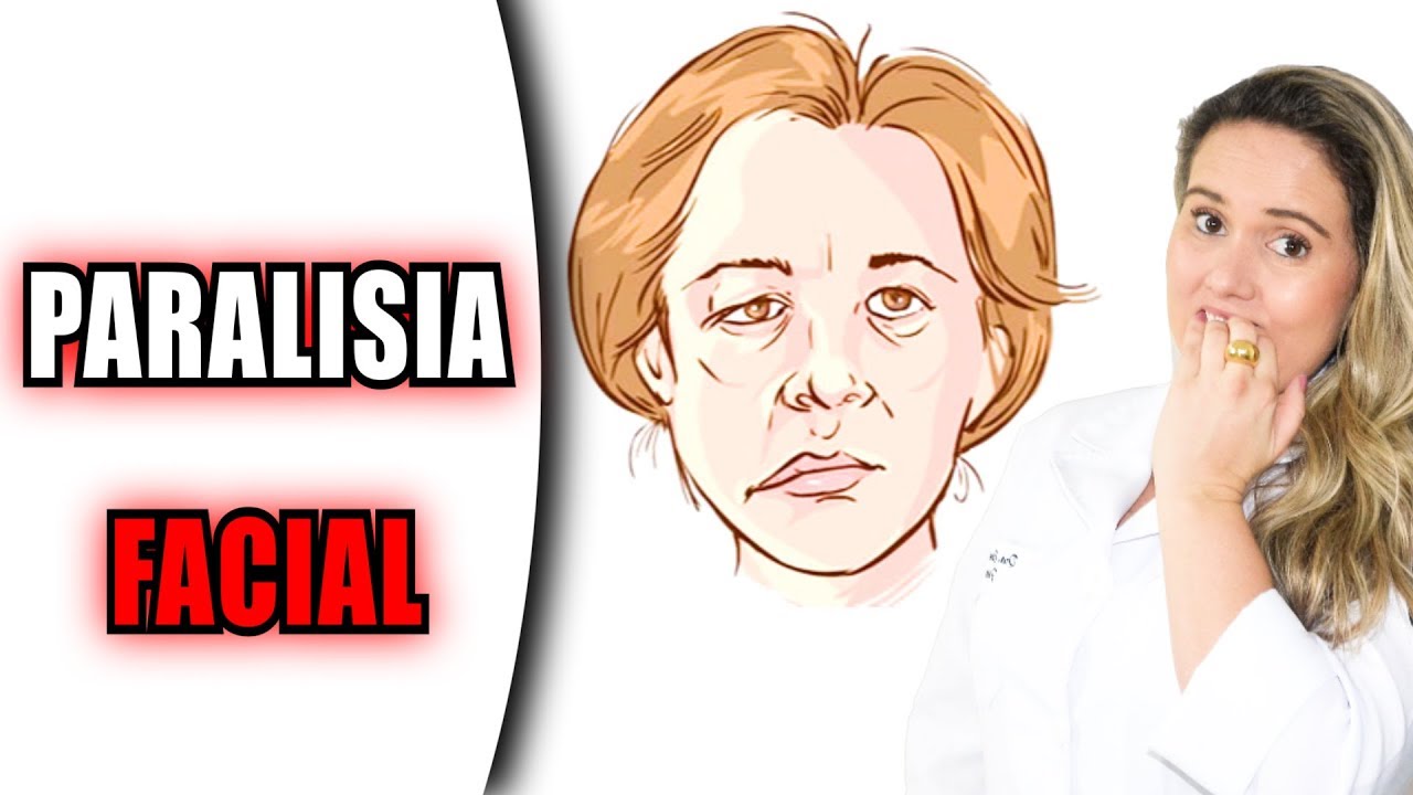 17 Dicas de Exerc&iacute;cios para Paralisia Facial