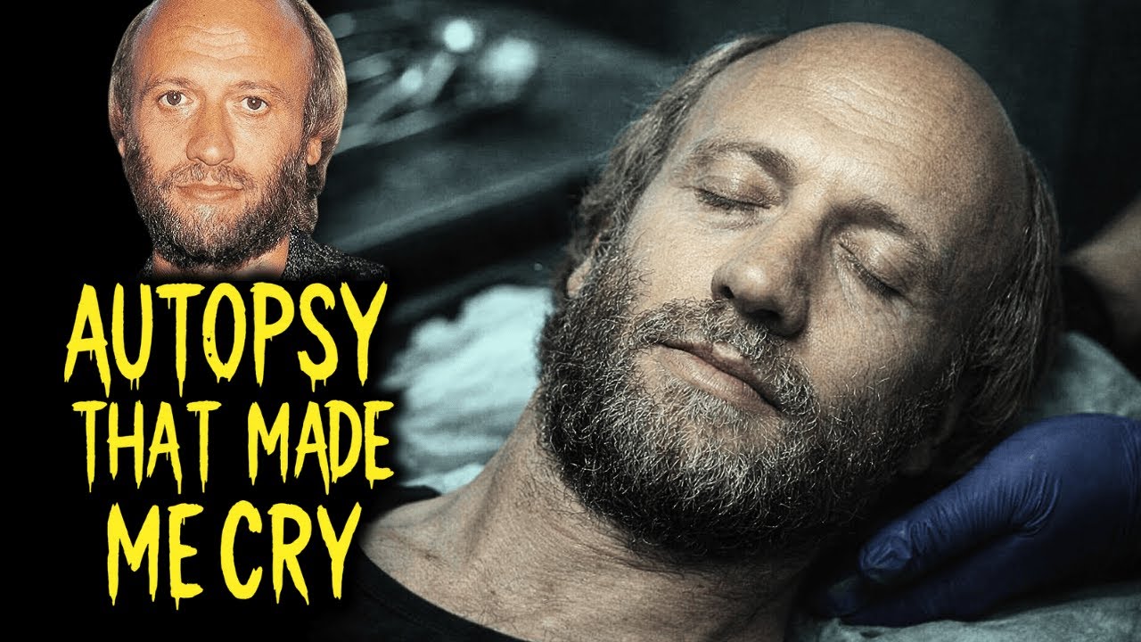 The Autopsy of Maurice Gibb | The Secret the Bee Gees Never Spoke Of