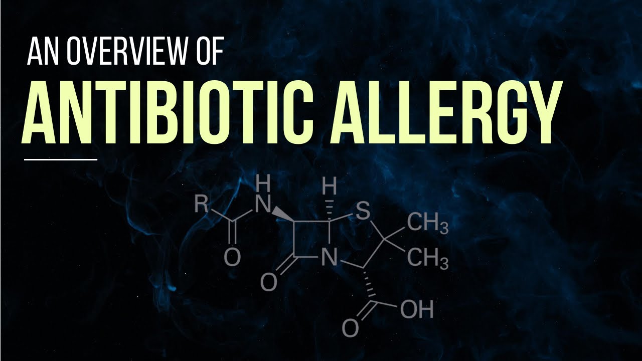 ANTIBIOTIC ALLERGY | An Overview of Assessment & Management