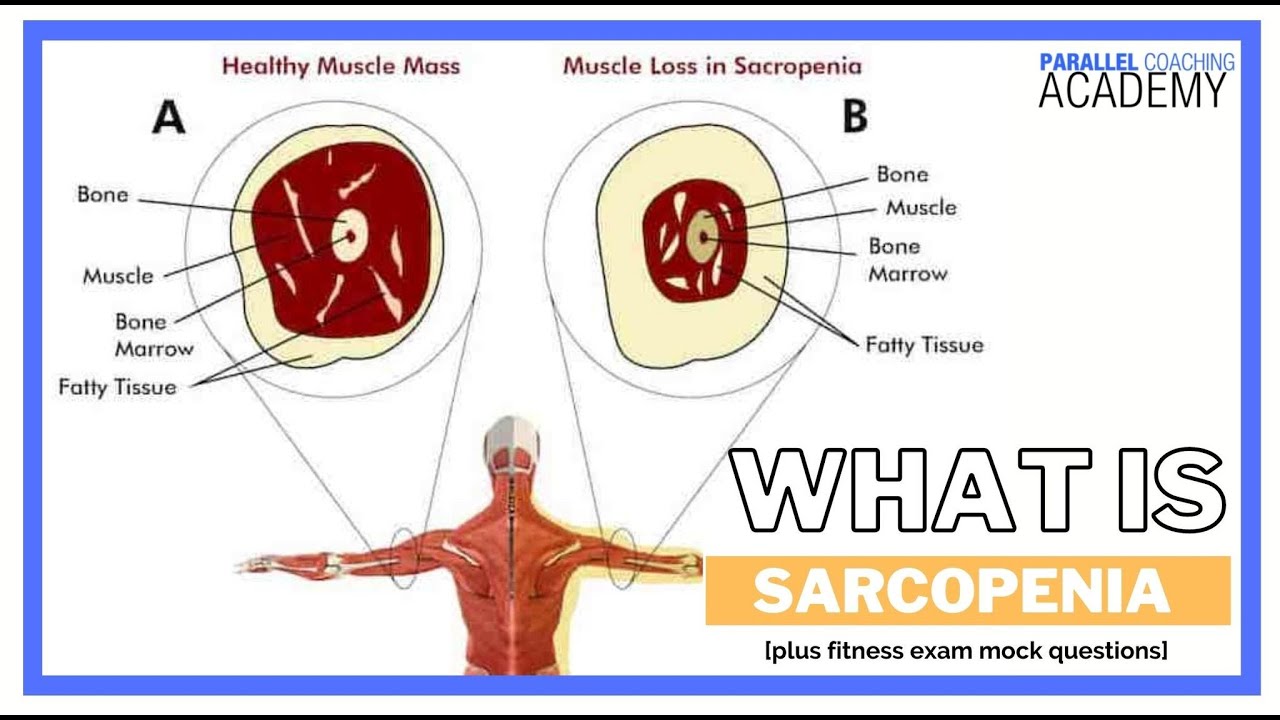 What is Sarcopenia?