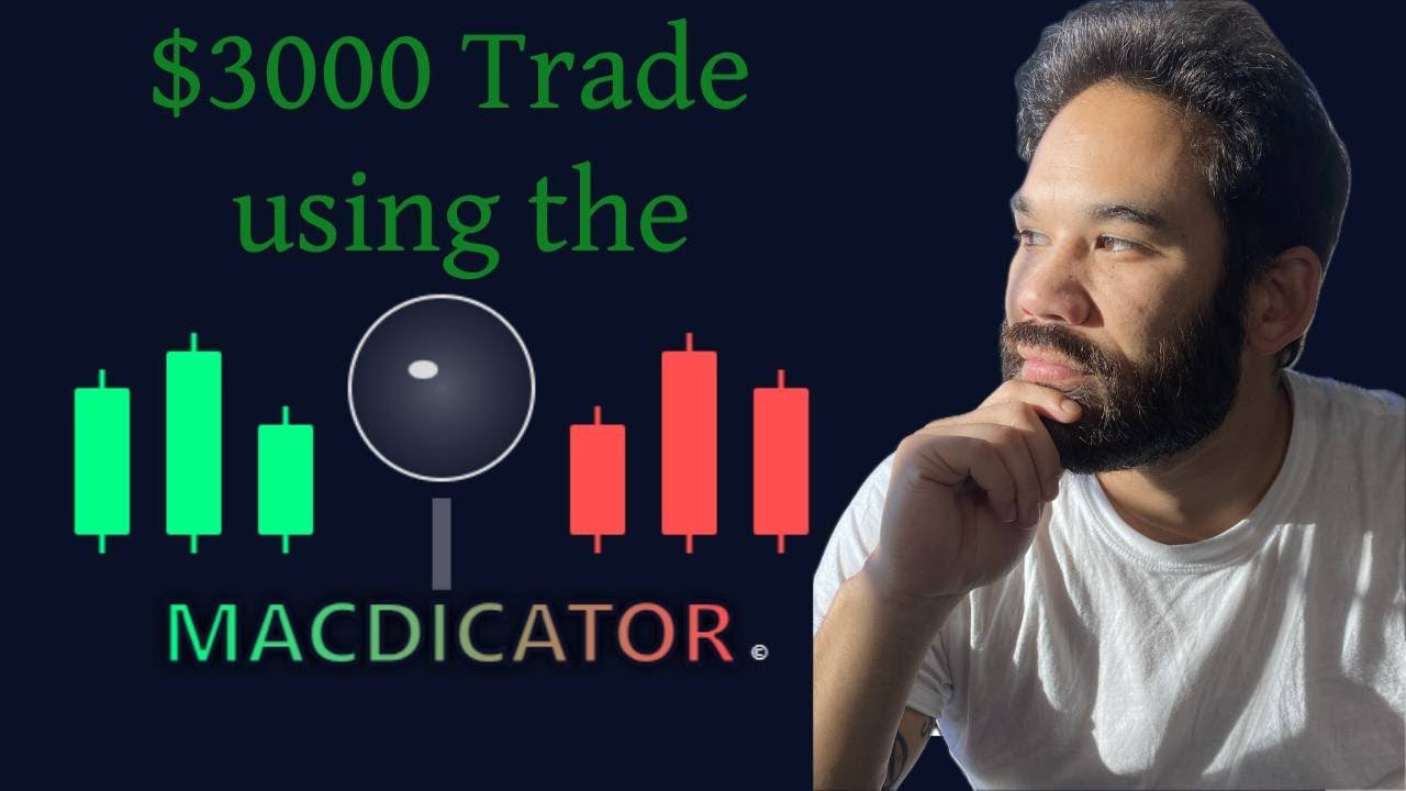 $3000 Trade using the Macdicator!!!
