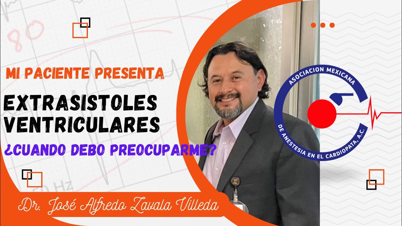 MI PACIENTE PRESENTA EXTRASISTOLES VENTRICULARES ¿CUANDO DEBO PREOCUPARME? DR ALFREDO ZAVALA VILLEDA