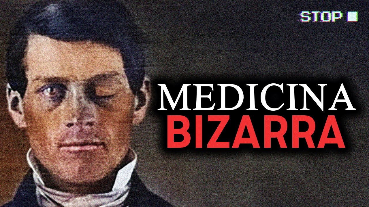 Casos Misteriosos Da Medicina