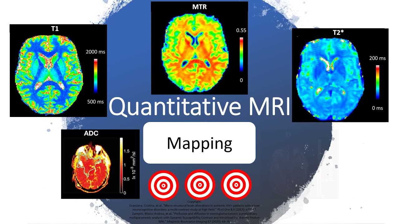 qMRI - Marco Andrea Zampini