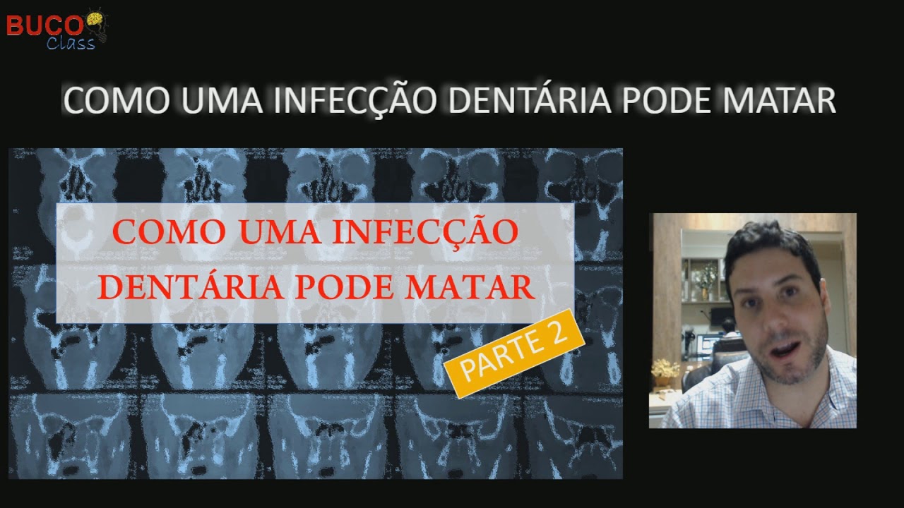INFECÇÃO DENTÁRIA PODE MATAR PARTE 2