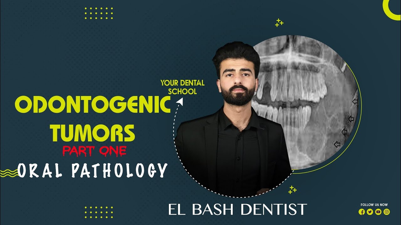 odontogenic tumors | ameloblastoma || part 1 || oral pathology _عزت شومان