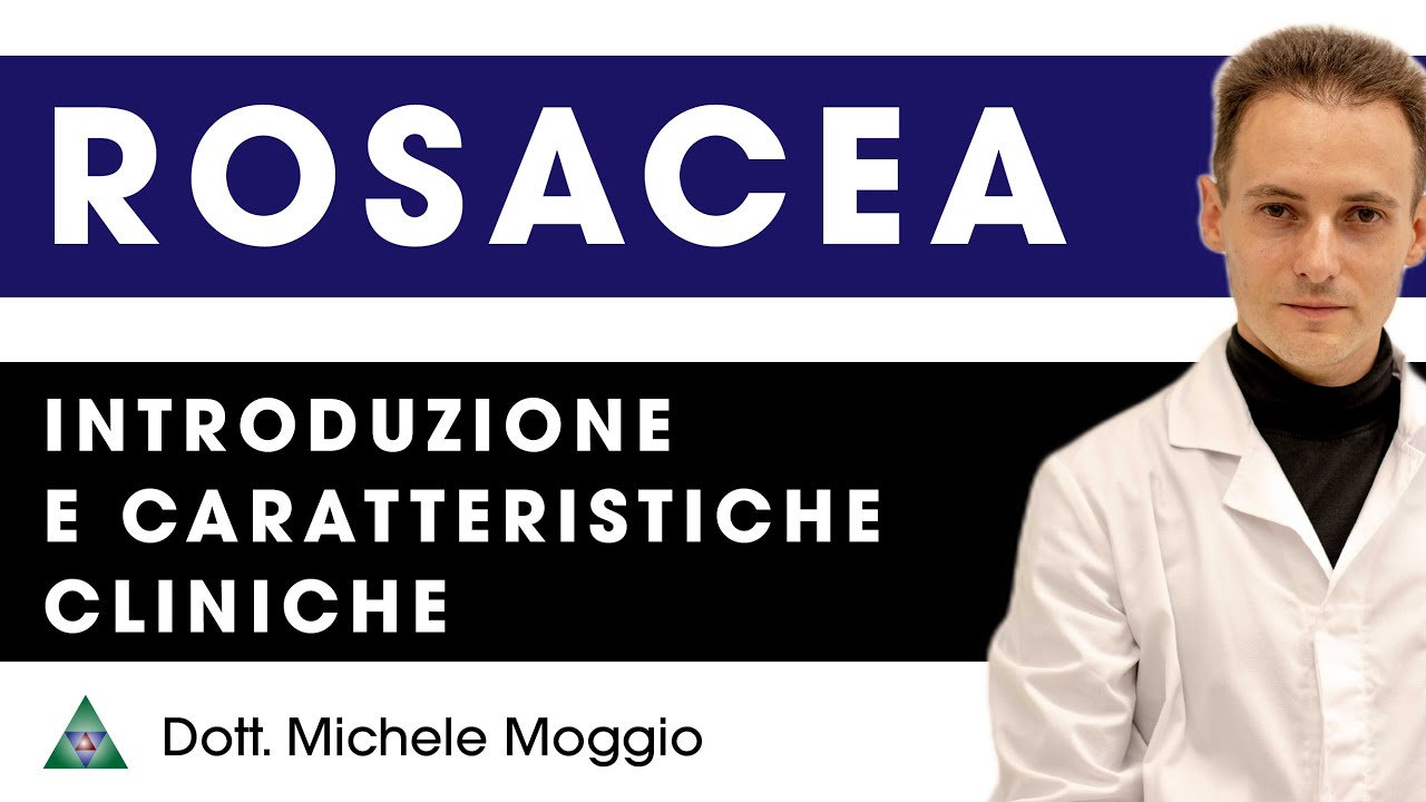 ROSACEA - Introduzione e caratteristiche cliniche