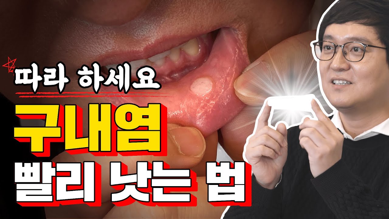 [구내염 치료 꿀팁3] 툭하면 입병 나는 사람~? 이것만 알면 끄-읕