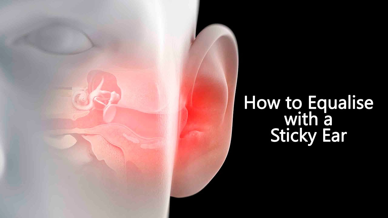 Advanced Frenzel and Mouthfill Tip | How to Equalise with a Sticky Ear