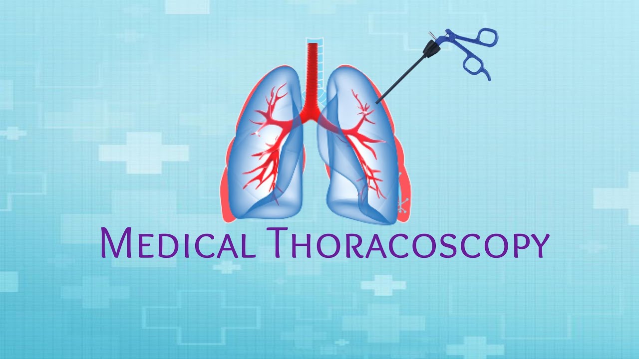 Medical Thoracoscopy