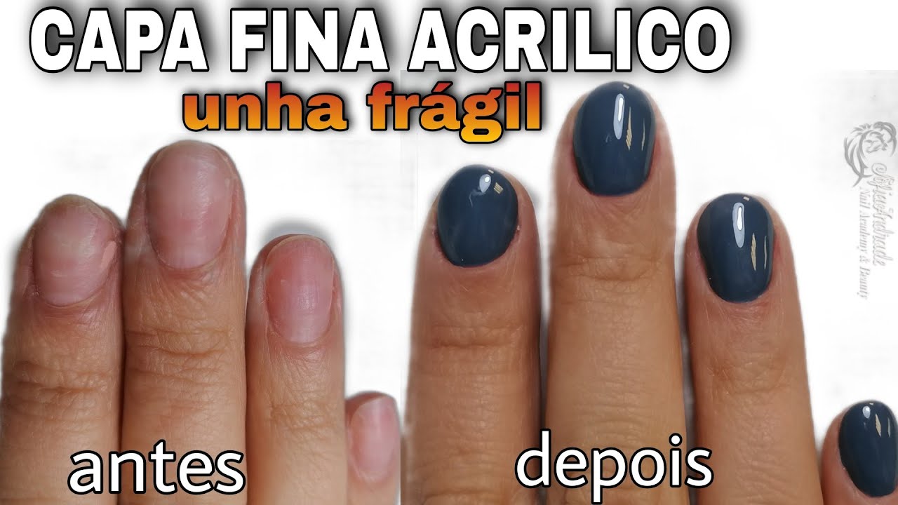 Unha frágil e capa proteção de acrilico ultra fino rapido sem dor resistente protetor