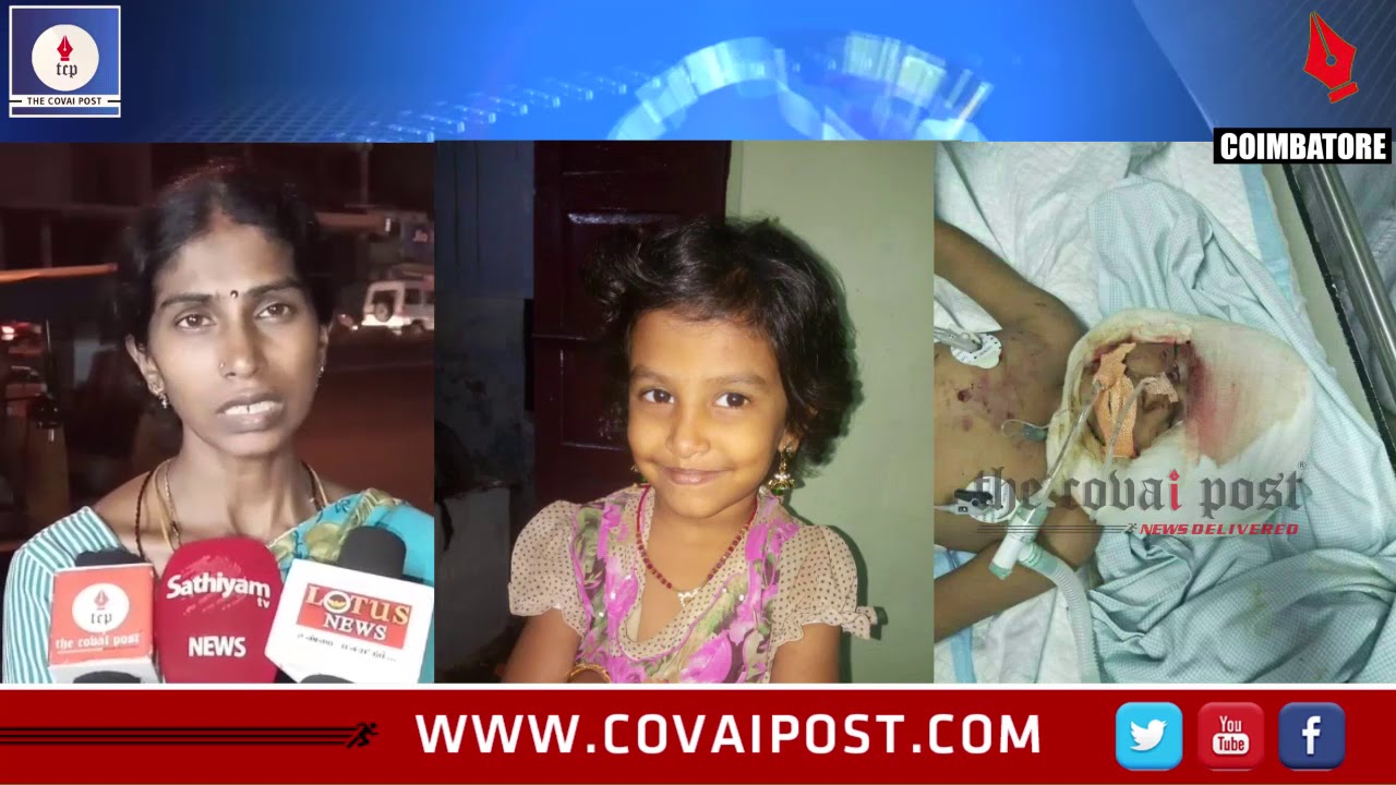 In a freak incident a 6 year old girl was mauled by a pet dog at Church road, Saibaba colony