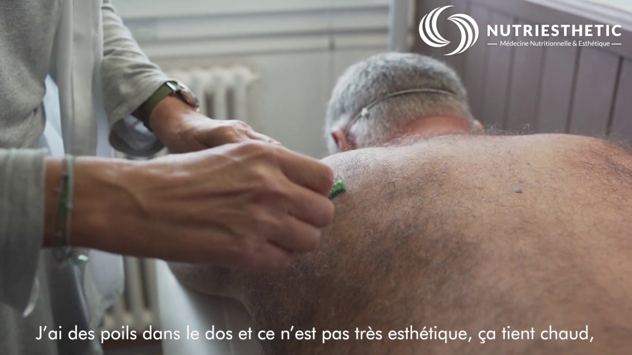 Epilation laser du dos chez l'homme à Liège