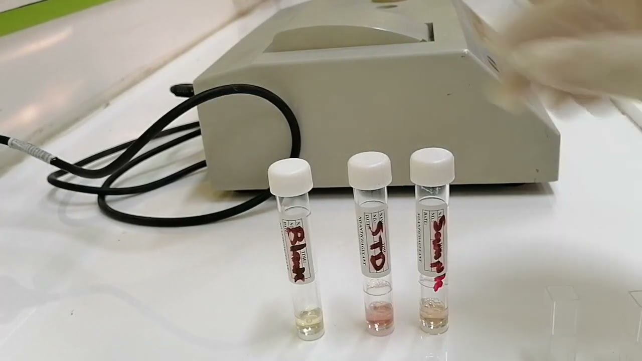 Determination of Triglycerides in the blood