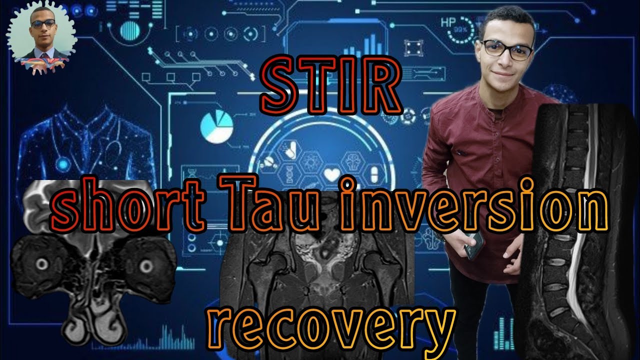 STIR ,,,short Tau inversion recovery,,,. الارتداد الانعكاسي القصير في الرنين المغناطيسي