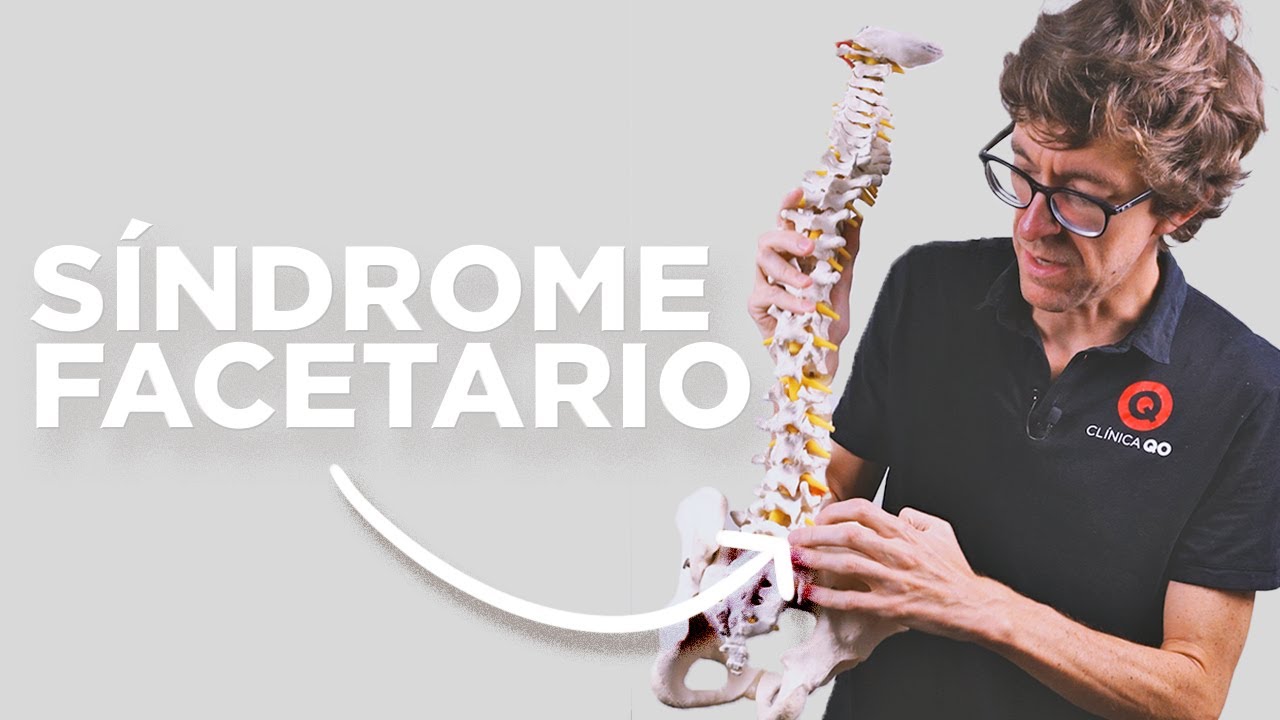 SÍNDROME FACETARIO: ¿Qué es y qué hacer?