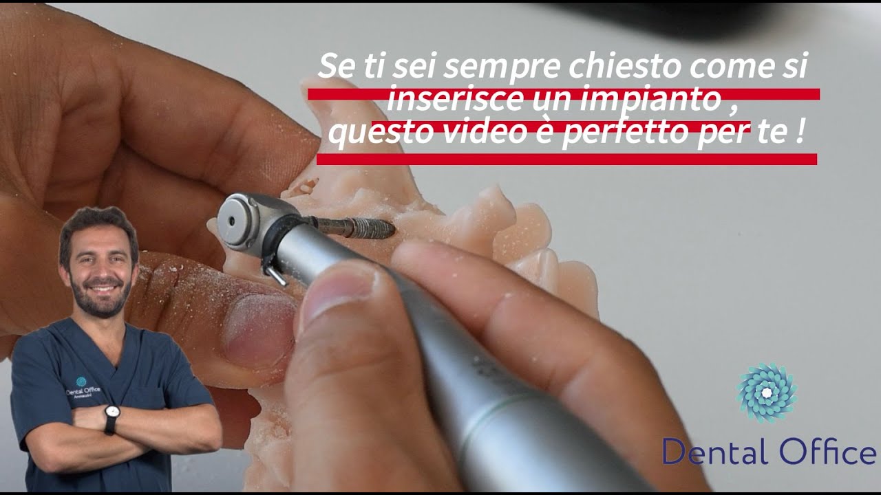 Ho inserito un IMPIANTO dentale dentro un OSSO di RESINA