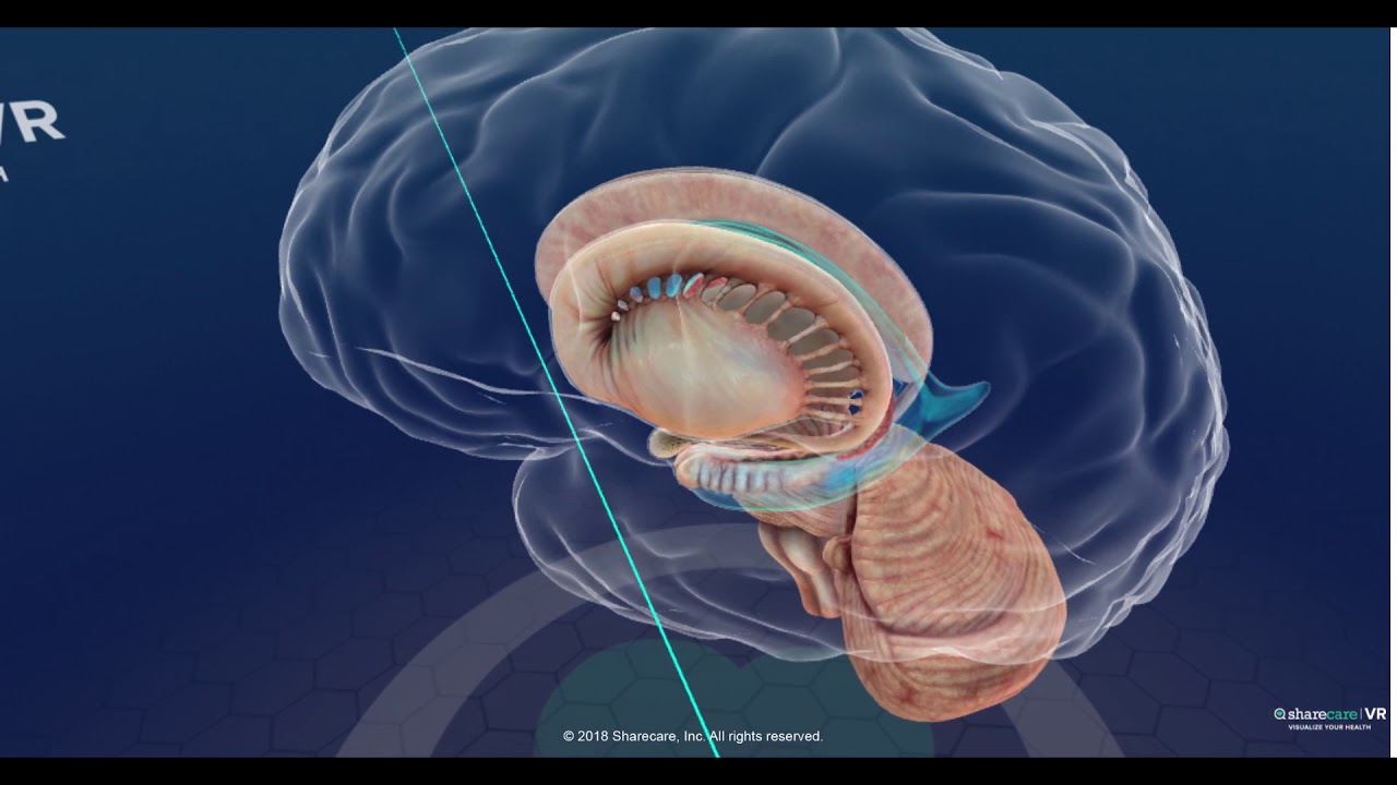 Sistema ventricular y flujo de líquido cefalorraquídeo