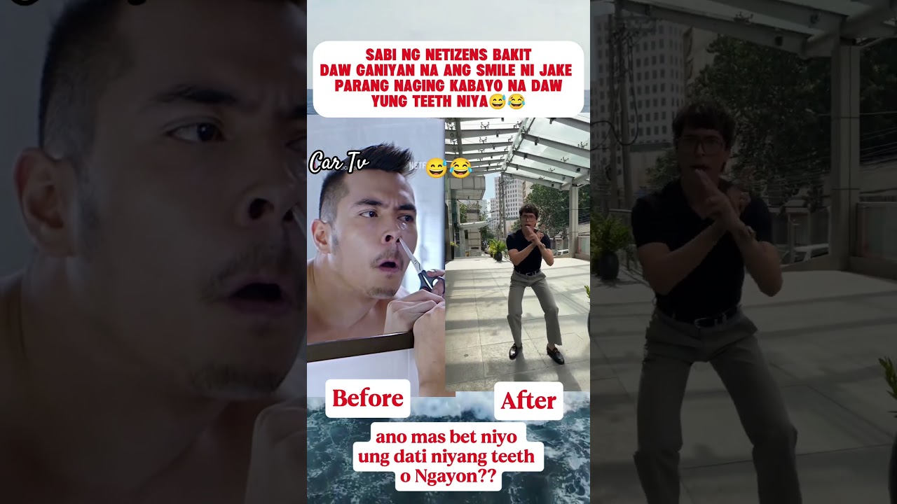 Jake Cuenca Before and After #youtubeshorts #youtubevideos #ytshorts #shorts