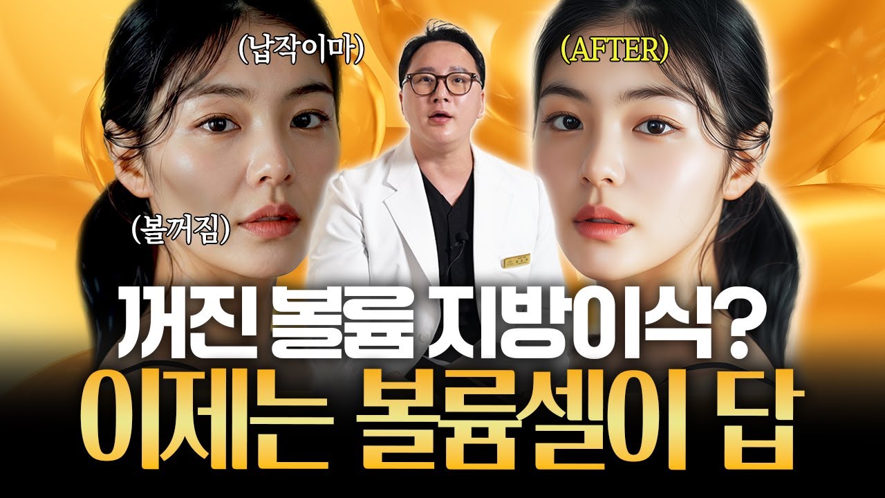 지방이식, 필러 제발 그만! 내 얼굴 살리는 '볼륨셀'의 비밀 ㅣ 부작용, 뭉침 없이 생착률 2배 높이는 핵심 기술