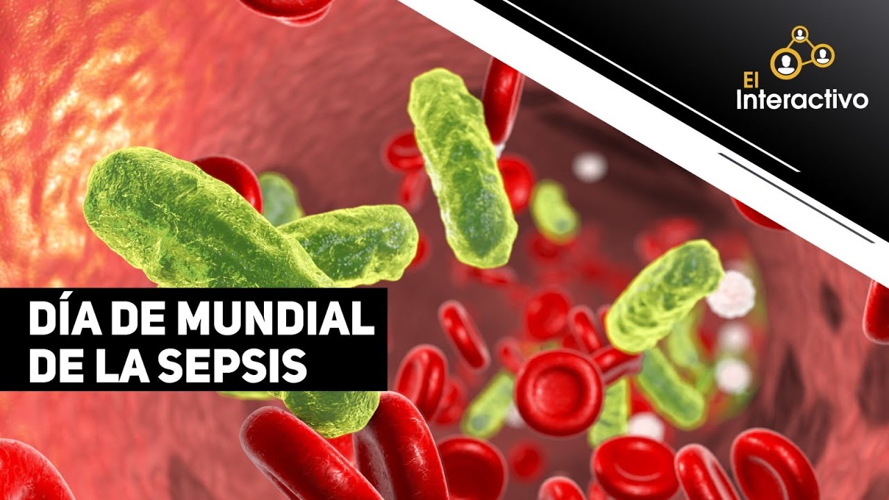 La Sepsis: Síntomas, Causas y Tratamiento