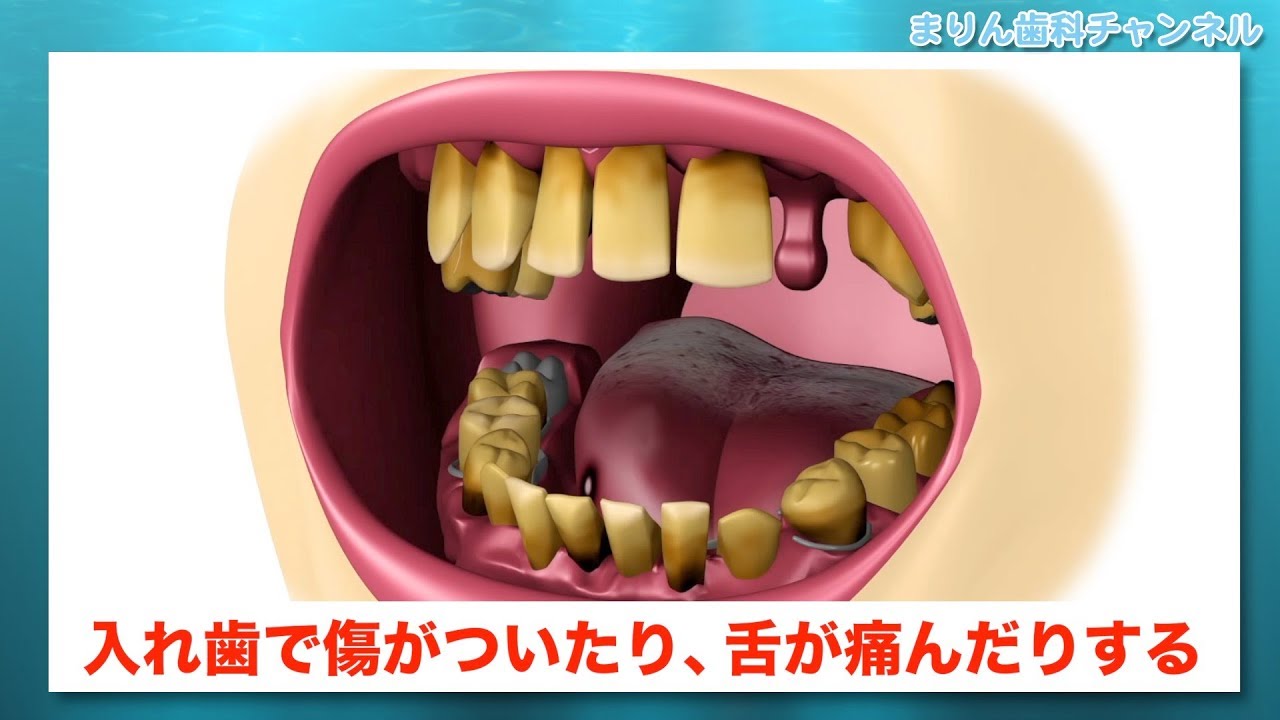 【小倉南区 門司区 歯医者】口腔機能低下、全身疾患につながる口腔乾燥症_まりん歯科チャンネル118（口腔ケアチャンネル）
