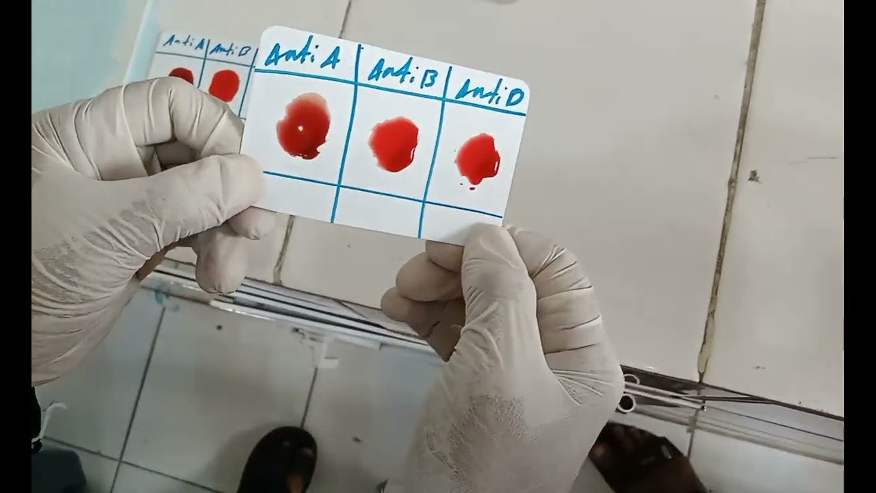 شاهد  كيفية عمل فصيلة الدم +O و -O من من تأخذ الدم ولمن تعطي بطريقة سهلة blood group O+Rh  and O-R h