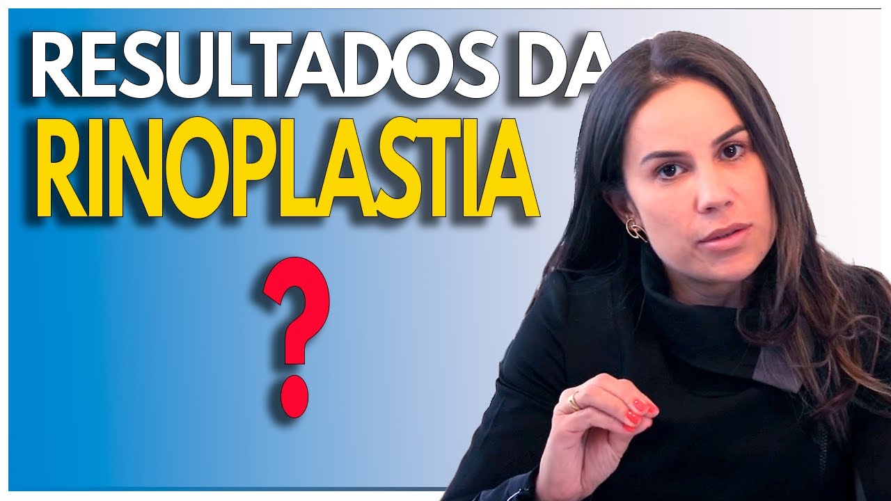 DESCOBRINDO os RESULTADOS da RINOPLASTIA: Prepare-se!