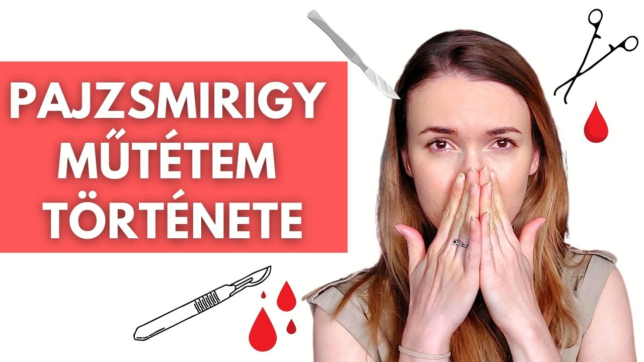 Pajzsmirigy eltávolító műtét tapasztalatok & tippek pajzsmirigy betegeknek