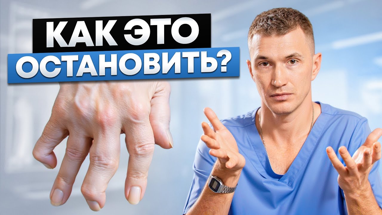 Первые признаки ОСТЕОПОРОЗА – проверь себя дома за 1 минуту
