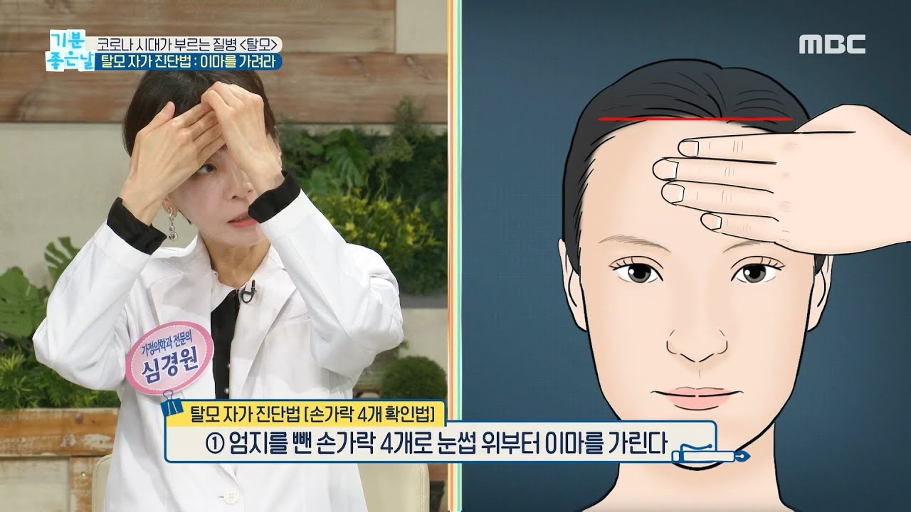 [기분 좋은 날] 코로나 시대가 부르는 질병! ＜탈모＞ 자가 진단법! MBC 201015 방송