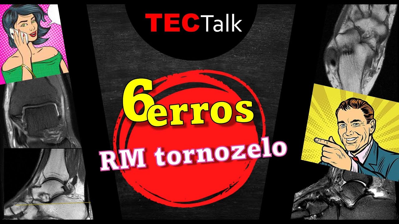 6 erros RM do tornozelo