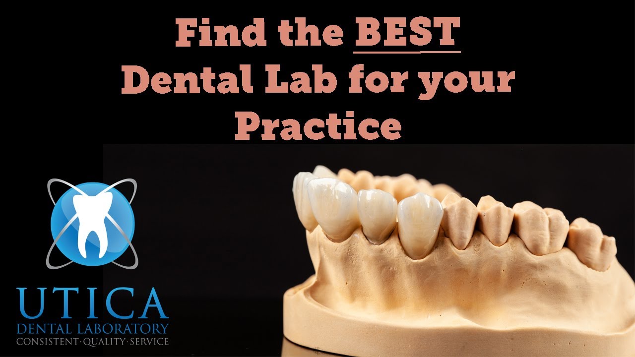 Top 5 Things to Look for When Choosing a Dental Lab