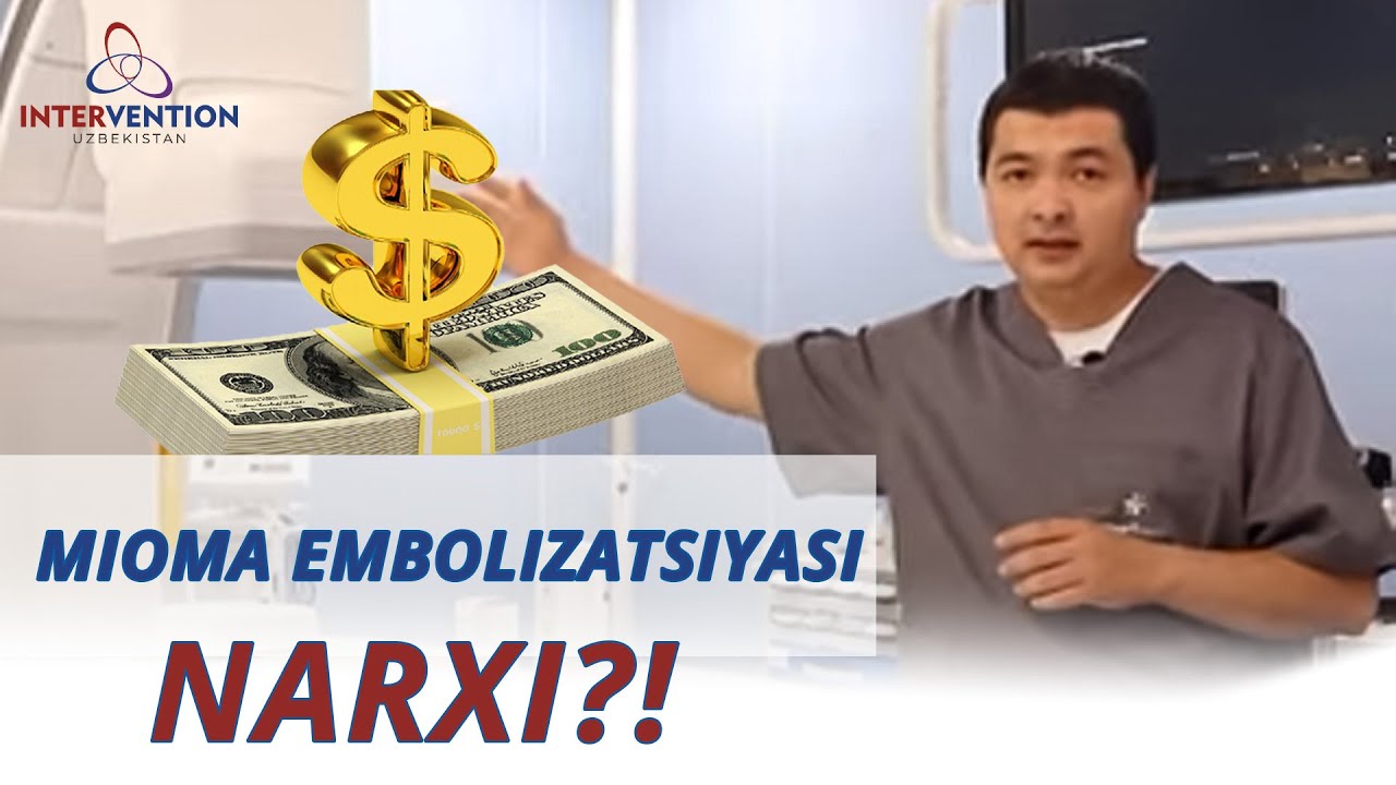 Mioma embolizatsiyasi va unga qo'yiladigan NARX!