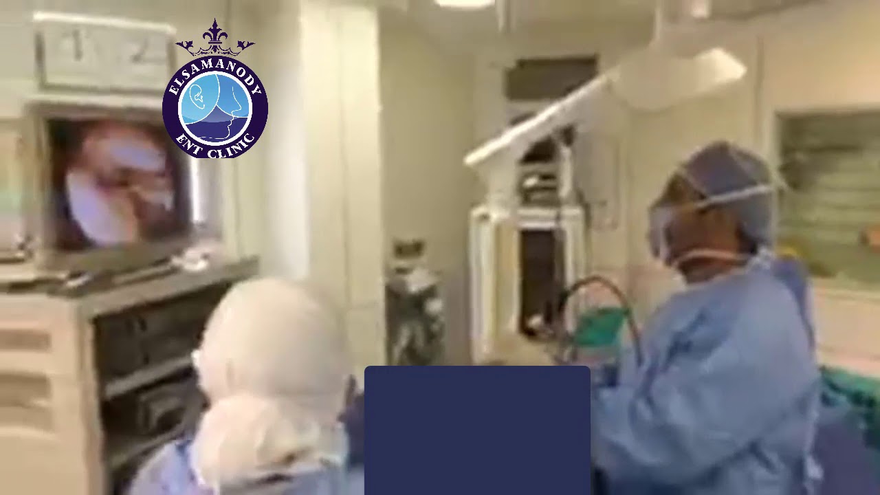 الدكتور احمد نبيل السمنودي - استشاري الانف والاذن والحنجرة وزراعة القوقعة استعدال الحاجز الانفي