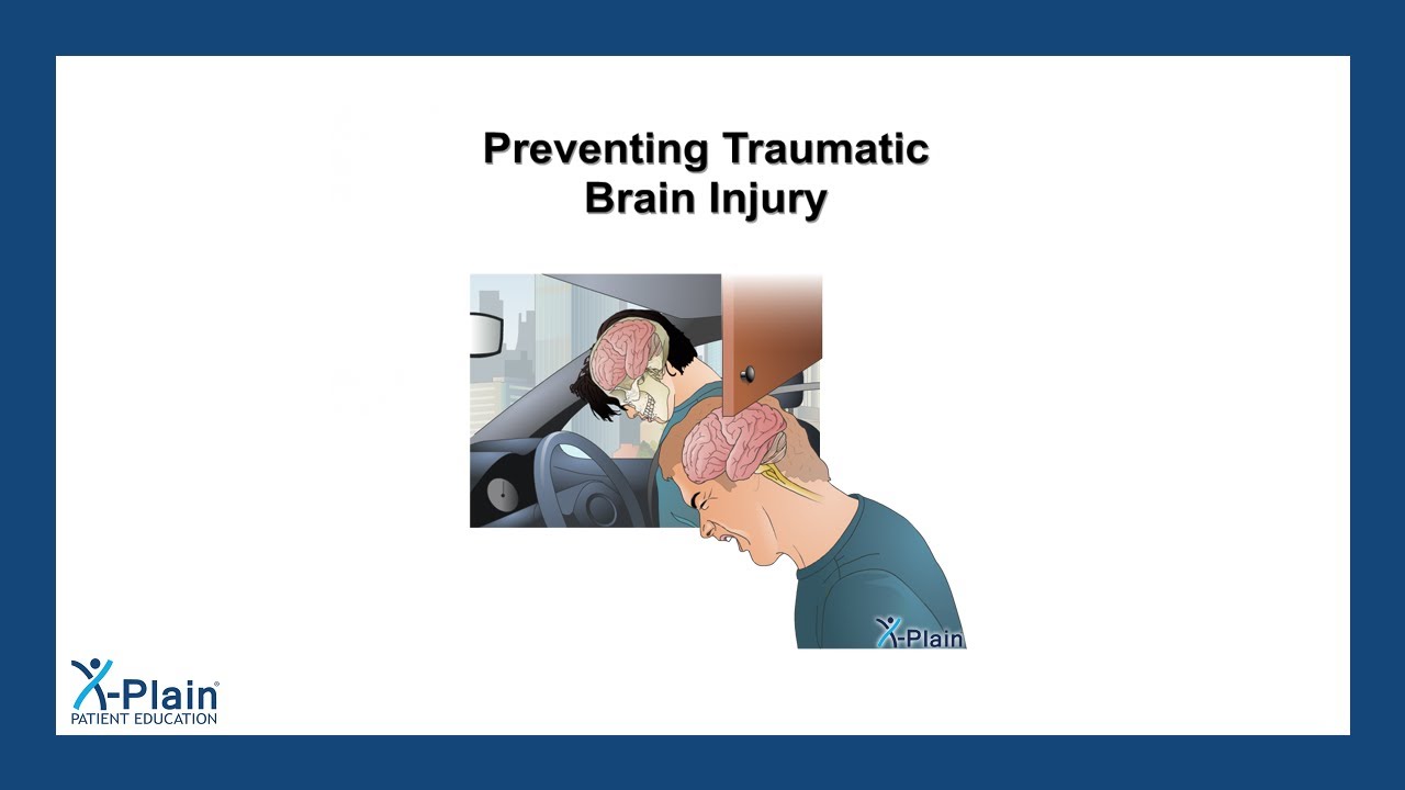 Preventing Traumatic Brain Injury
