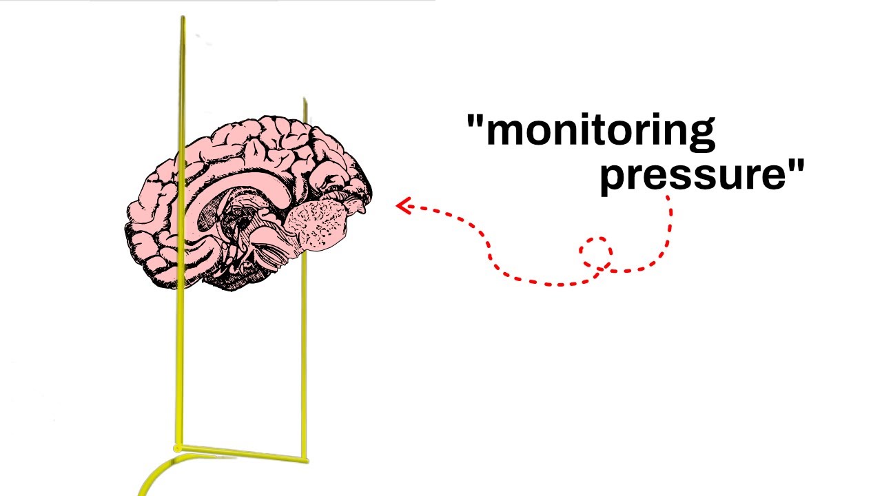 Researching How NFL Kickers Win Under Pressure