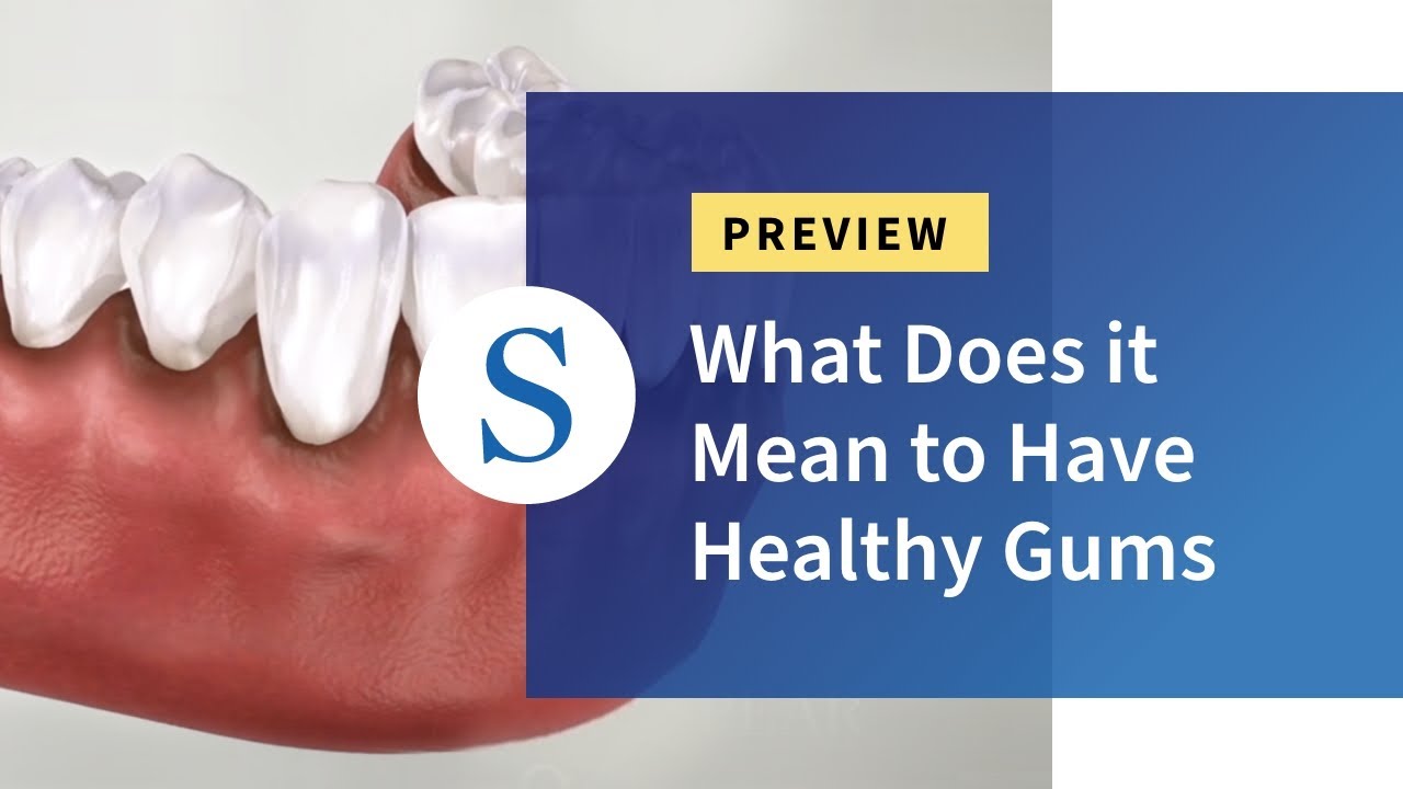 What Does it Mean to Have Healthy Gums. Patient Education Teaser.