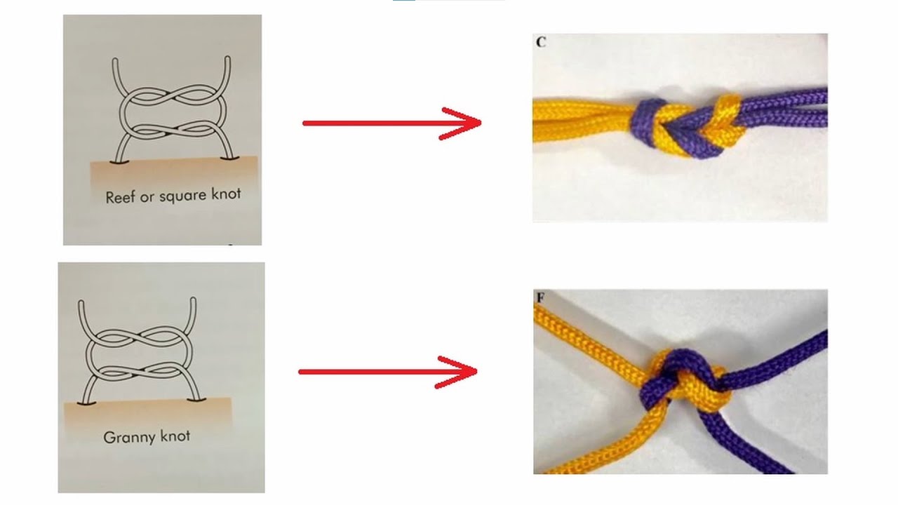 Knots In Surgery. The Only Knot You Need To Know.