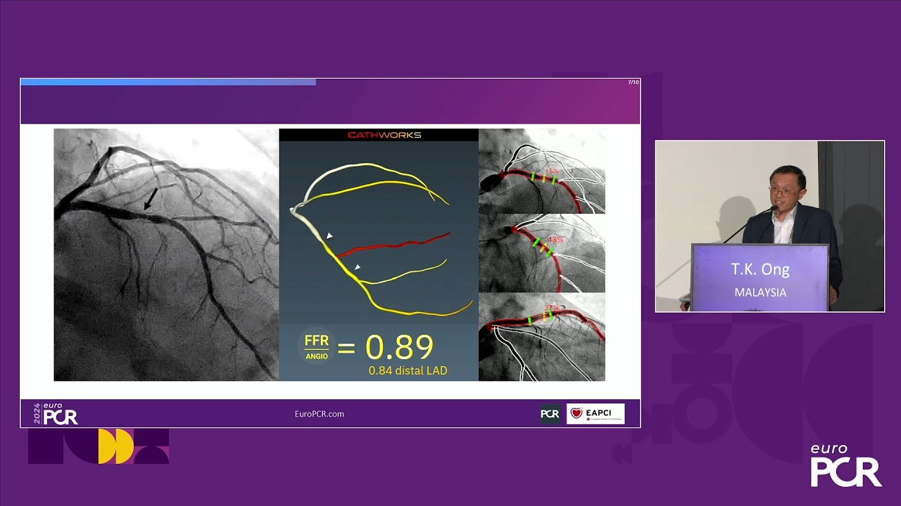 How do I confidently expand my DCB practice? - EuroPCR 2024