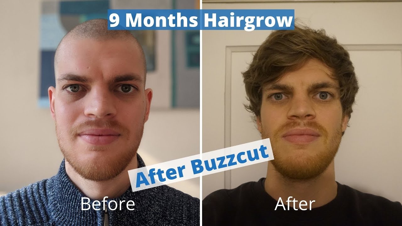 Hair Growth Time Lapse 9 Months - From Buzz Cut