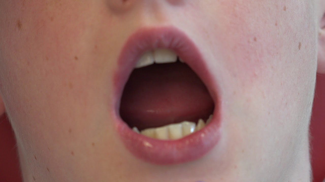 Curve Collis Toothbrushing