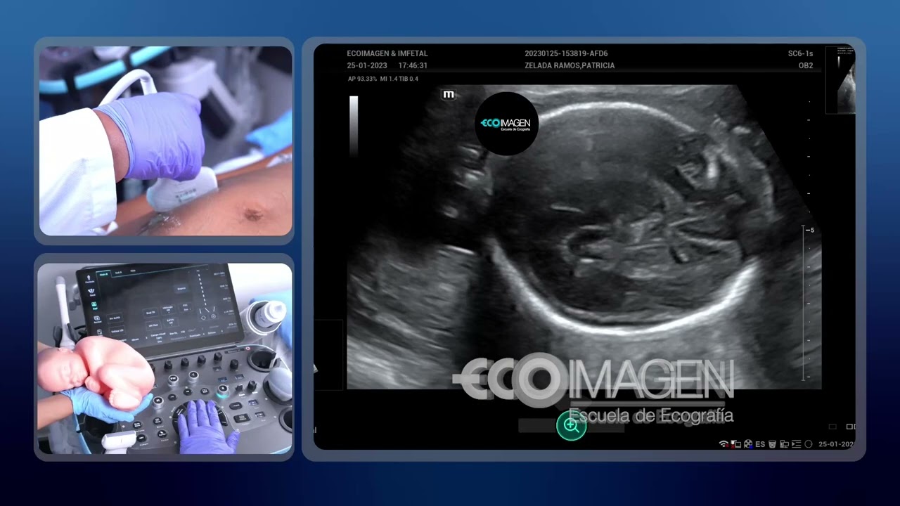 EcoimagenTips: ¿𝗖𝗼𝗺𝗼 𝗿𝗲𝗮𝗹𝗶𝘇𝗮𝗿 𝗹𝗮 𝗕𝗜𝗢𝗠𝗘𝗧𝗥𝗜́𝗔 𝗙𝗘𝗧𝗔𝗟?