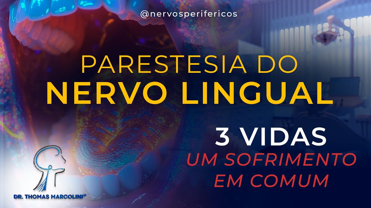 Parestesia do Nervo Lingual - Hístória Reais, Documentário Completo!