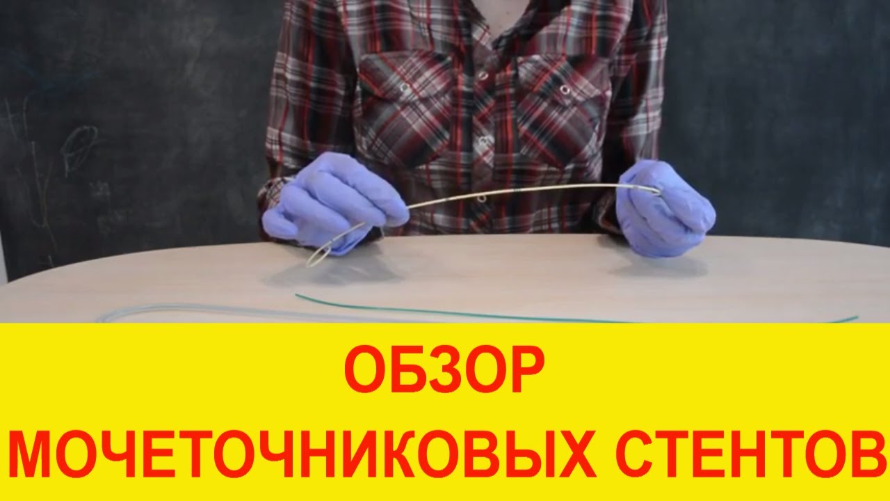 Обзор урологического мочеточникового стента