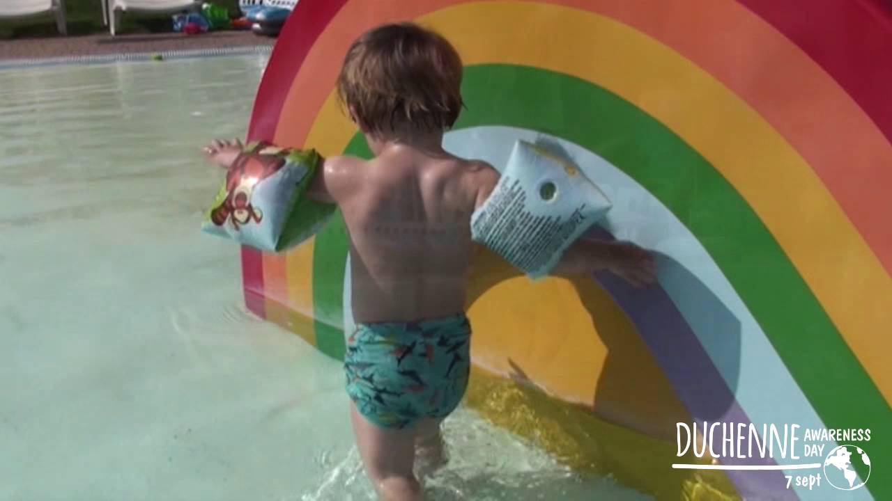 Early Signs of Duchenne Muscular Dystrophy