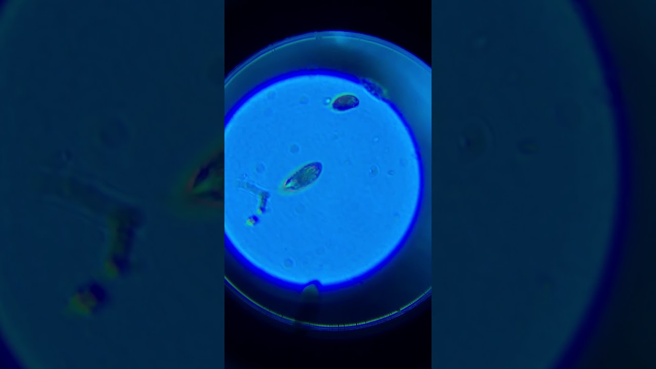 Ostreopsis Dinos