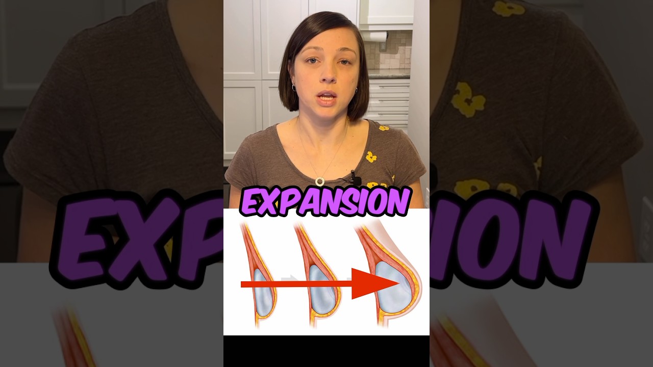 What do Tissue Expanders FEEL Like? #breastreconstruction