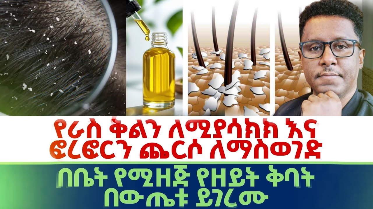 Ethiopian |ፀጉር #ለማሳደግ|የራስ ቅልን #ለሚያሳክክ እና #ፎረፎርን ጨርሶ #ለማስወገድ | #በቤት የሚዘጅ #የዘይት ቅባት  | #በውጤቱ ይገረሙ