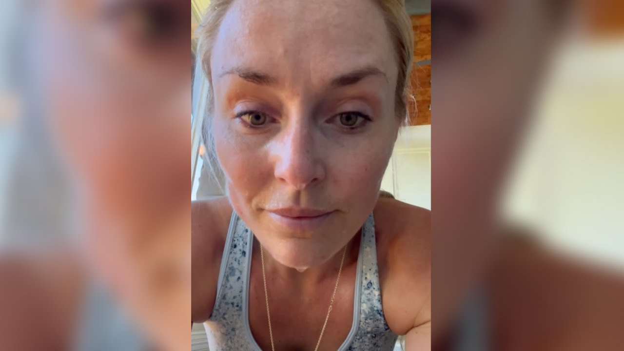 Lindsey Vonn Speaks Out After Olympic Crash